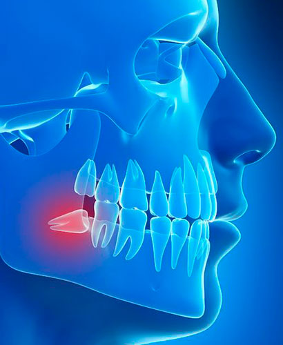 Curso de Posgrado de Cirugía: Técnicas quirúrgicas para piezas dentarias retenidas
