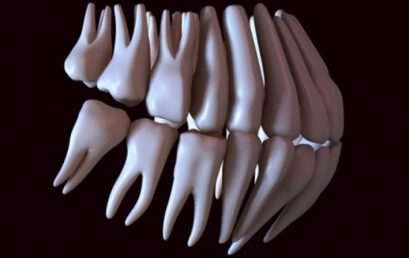 Estudio biomecánico de postes preformados en primeros premolares superiores