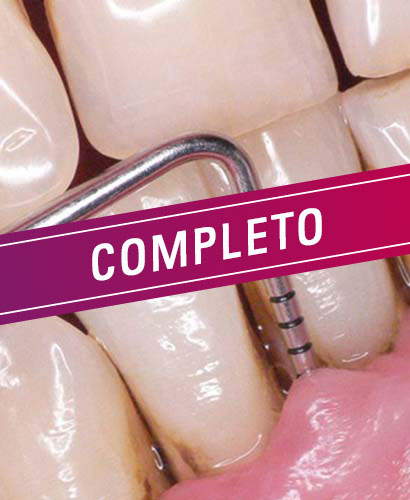 Periodoncia – 100% ONLINE