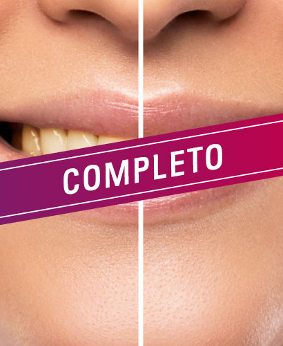 Blanqueamiento Dental – 100% ONLINE