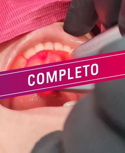 Láser: Simplificando la Odontopediatría – 100% ONLINE
