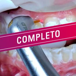 Odontología Laser completo