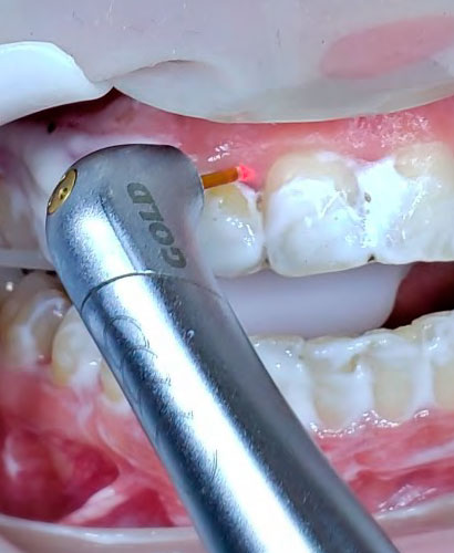 Odontología Laser – 100% ONLINE