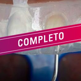 curso Rehabilitacion Adhesiva-completo