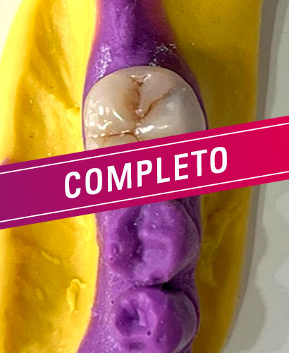 Posgrado en Estética: Rehabilitaciones estéticas en resinas