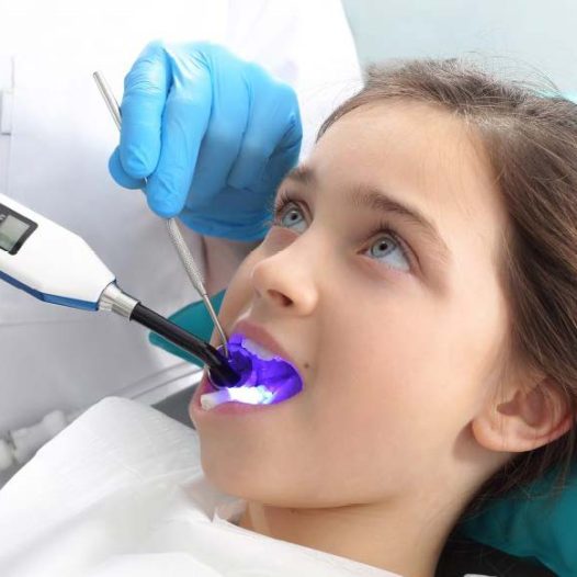 LÁSER: Simplificando la Odontopediatría