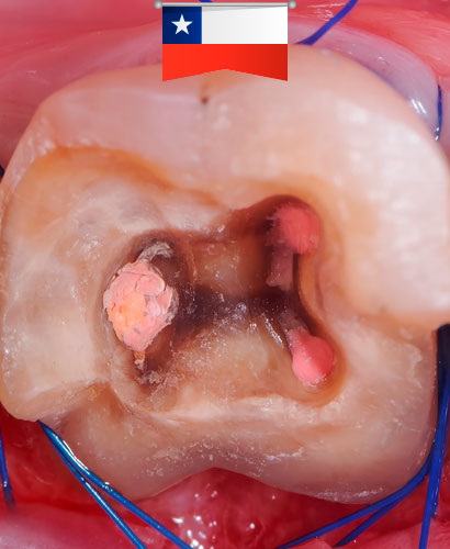 Reconstrucción Quirúrgico-Adhesiva – 100% ONLINE