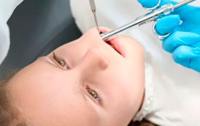 Anestesia Intraósea en Odontología Pediátrica – 100% ONLINE
