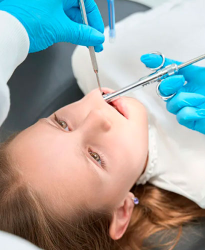 Anestesia Intraósea en Odontología Pediátrica – 100% ONLINE