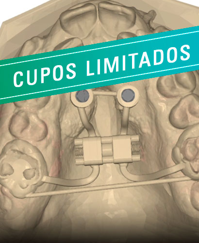 Jornada Gratuita: MARPE