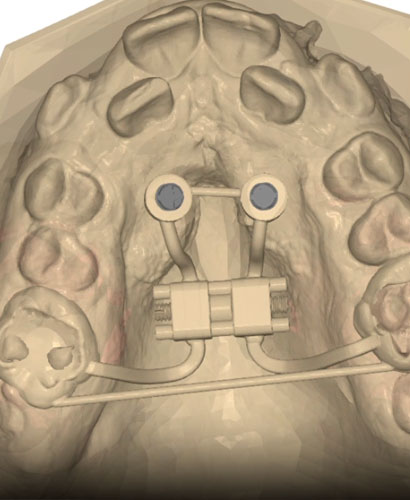Jornada Gratuita: MARPE