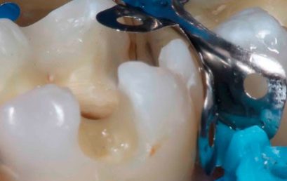 Odontología Estética y Adhesiva – 100% ONLINE