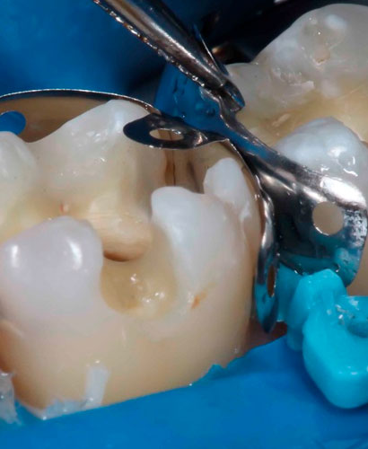 Odontología Estética y Adhesiva – 100% ONLINE