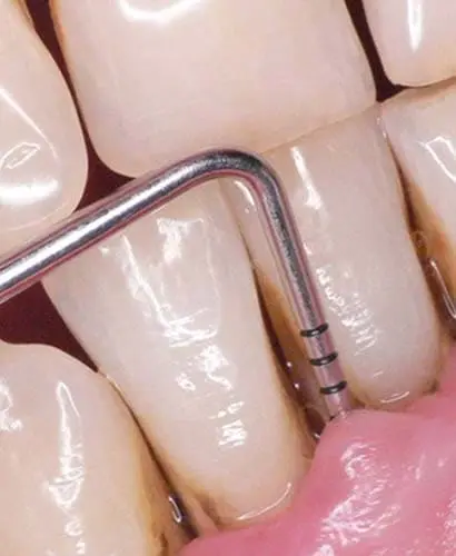 Diplomatura en Periodoncia: Cirugía Periodontal y Periimplantaria – 100% ONLINE