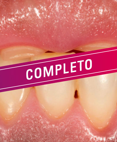 Curso Presencial Teórico-práctico – ReBUILD Rehabilitación Oral