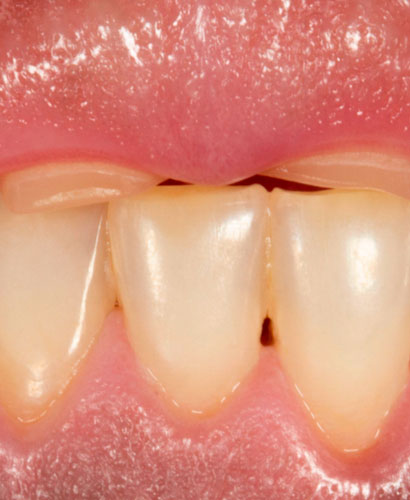 Curso Presencial Teórico-práctico – ReBUILD Rehabilitación Oral